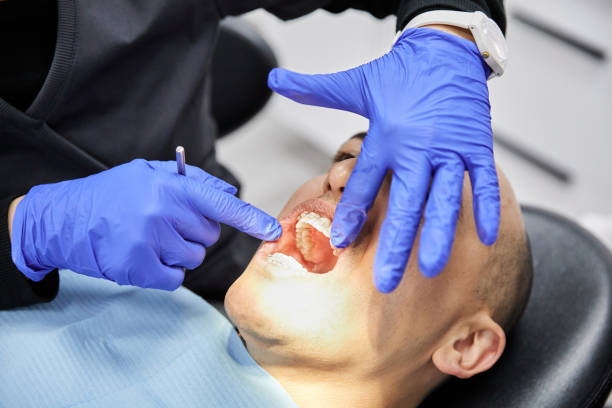 Best Emergency Wisdom Teeth Removal in Boyd, TX